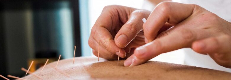 Healing Way Acupuncture